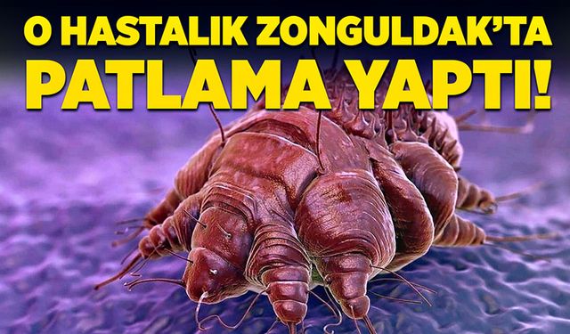 Dikkat: O hastalık Zonguldak’ta patlama yaptı!