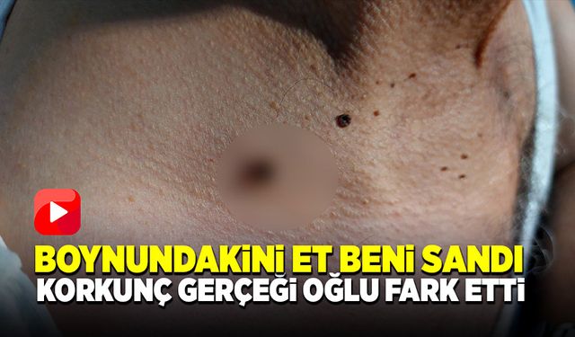 Boynundakini et beni sandı korkunç gerçeği oğlu fark etti!