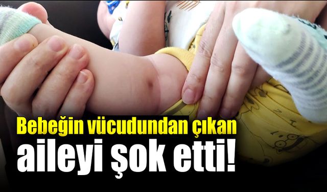 Sürekli ağlayan 2 aylık bebeğin vücudundan çıkan aileyi şok etti!