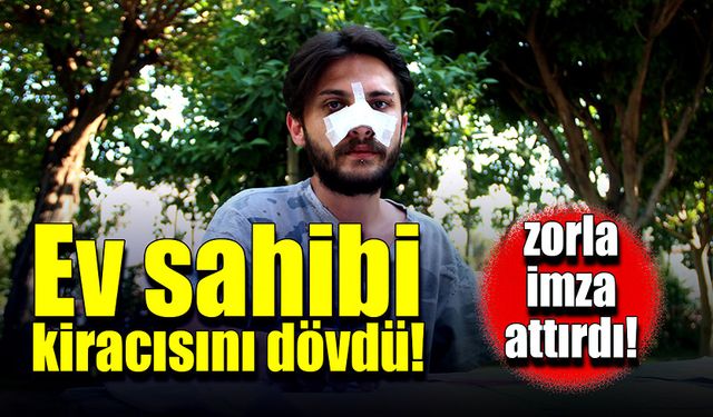 Ev sahibi kiracısını dövdü! Zorla imza attırdı!