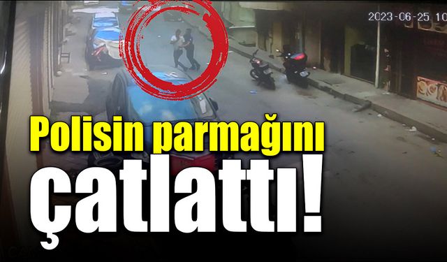 Polis memurunun parmağını çatlattı!