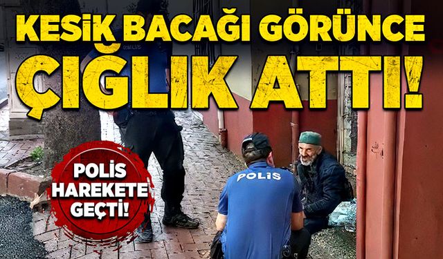 Kesik bacağı görünce çığlık attı! Polis Harekete geçti!