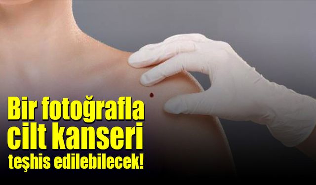 Tek bir fotoğrafla cilt kanseri teşhis edilebilecek!