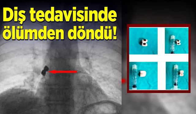 Gurbetçi, diş tedavisinde ölümden döndü!