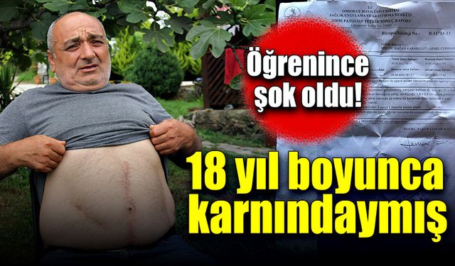 18 yıl boyunca karnındaymış! Öğrenince şok oldu!