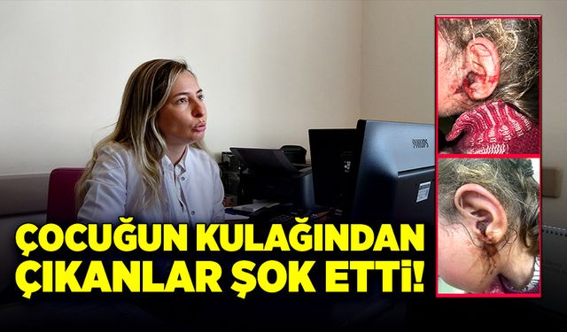 Çocuğun kulağından çıkanlar şok etti!