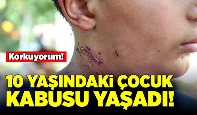 10 yaşındaki çocuk kabusu yaşadı! Korkuyorum