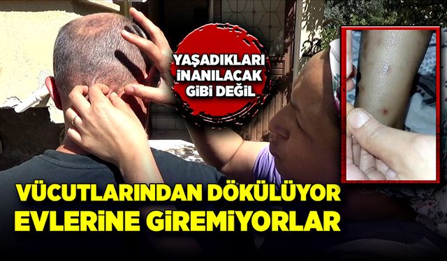 Vücutlarından dökülüyor, evlerine giremiyorlar! O aile yardım bekliyor