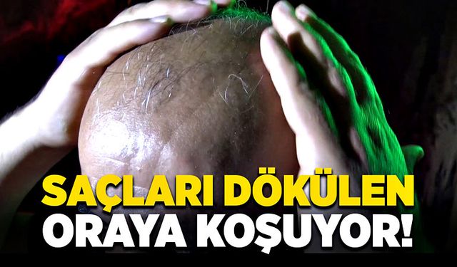 Saçları dökülenler oraya koşuyor!