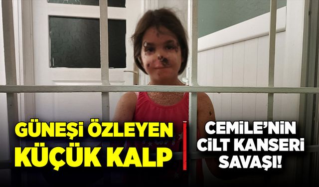 Güneşi özleyen küçük kalp: Cemile'nin cilt kanseri savaşı!