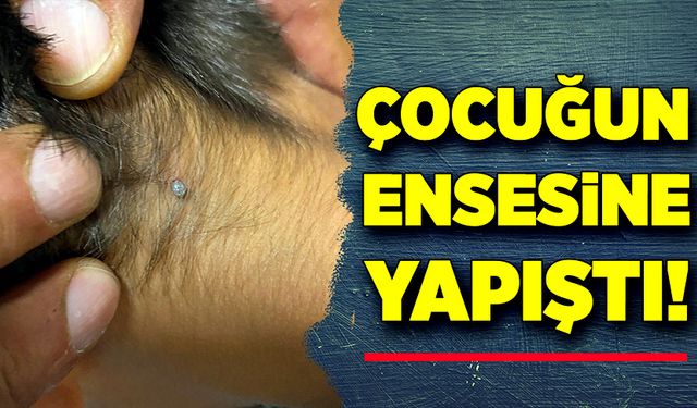 Çocuğun ensesine yapıştı!