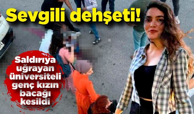 Saldırıya uğrayan üniversiteli genç kızın bacağı kesildi