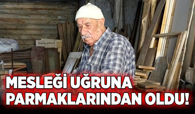 Mesleği uğruna parmaklarından oldu!