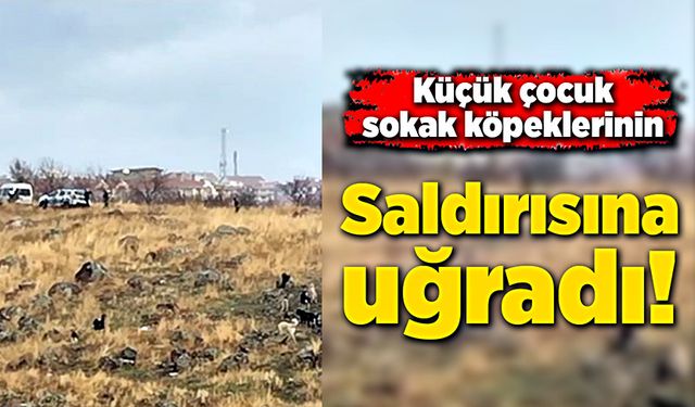 Küçük çocuk sokak köpeklerinin saldırısına uğradı!