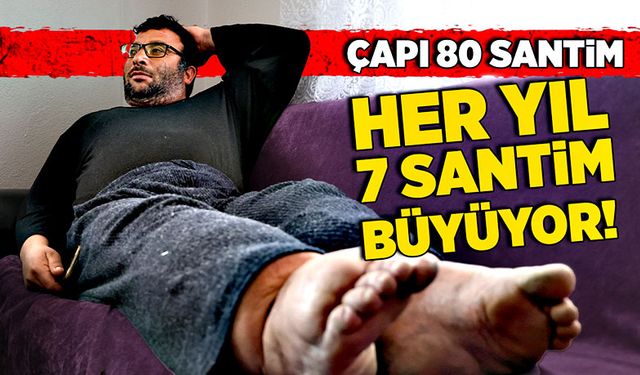 Bacaklarının çapı 80 santim! Her yıl 7 santim büyüyor!