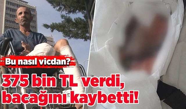 Bu nasıl vicdan? 375 bin TL verdi, bacağını kaybetti!