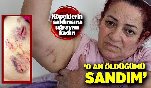 Köpeklerin saldırısına uğrayan kadın: "Ben o an öldüğümü sandım"