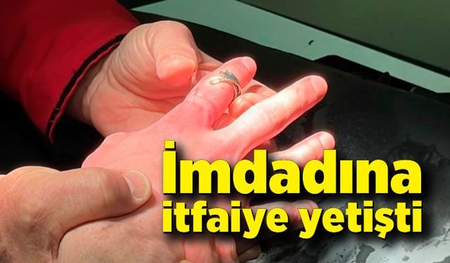 Parmağına yüzük sıkışan vatandaşın imdadına itfaiye yetişti