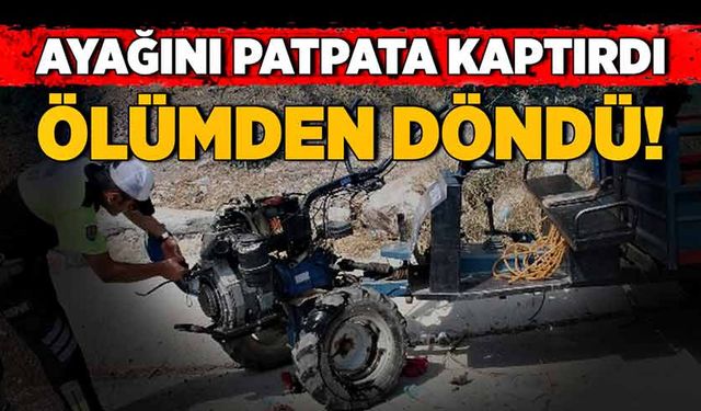 Ayağını patpata kaptırdı, ölümden döndü