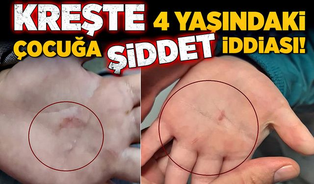 Kreşte 4 yaşındaki çocuğa şiddet iddiası!