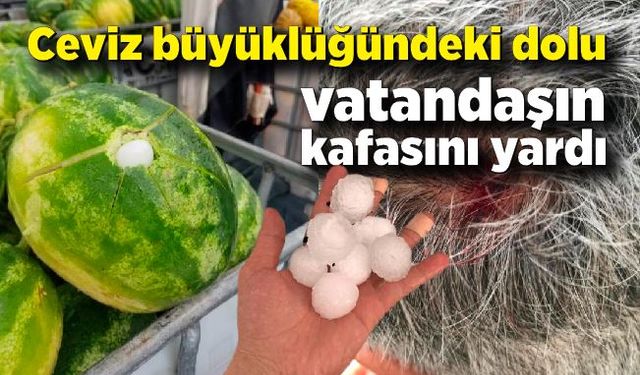 Ceviz büyüklüğündeki dolu vatandaşın kafasını yardı