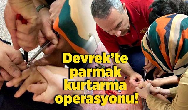 Devrek’te parmak kurtarma operasyonu!