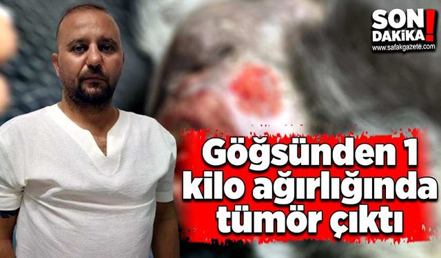 Göğsünden 1 kilo ağırlığında tümör çıktı