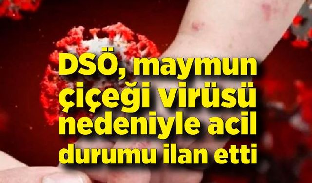 DSÖ, maymun çiçeği virüsü nedeniyle acil durumu ilan etti