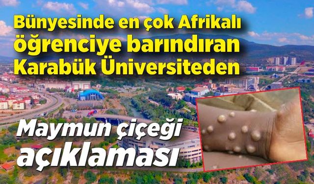 Karabük Üniversitesi'nden Maymun Çiçeği açıklaması