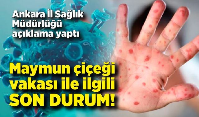 Maymun çiçeği vakası ile ilgili açıklama