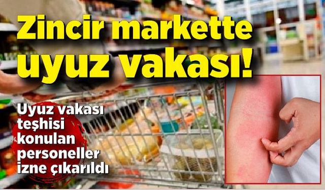 Zincir markette uyuz vakası! Personel izne ayrıldı