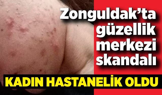 Zonguldak’ta güzellik merkezi skandalı: Cilt bakımı yaptıran kadın hastanelik oldu