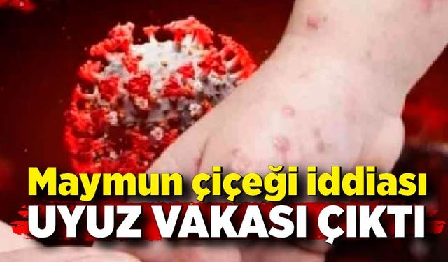 Maymun çiçeği iddiası uyuz vakası çıktı