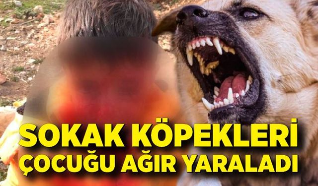 Başıboş köpeklerin saldırdığı çocuk ağır yaralandı