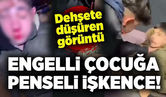 Dehşete düşüren görüntü: Engelli çocuğa penseli işkence!