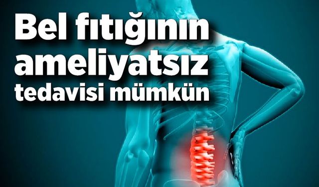 Bel fıtığının ameliyatsız tedavisi mümkün