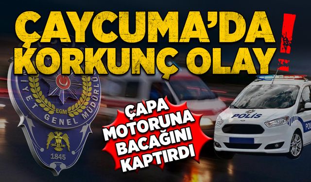 Çaycuma’da korkunç olay: Çapa motoruna bacağını kaptırdı