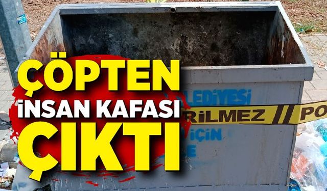 Çöp konteynerinden insan kafatası çıktı
