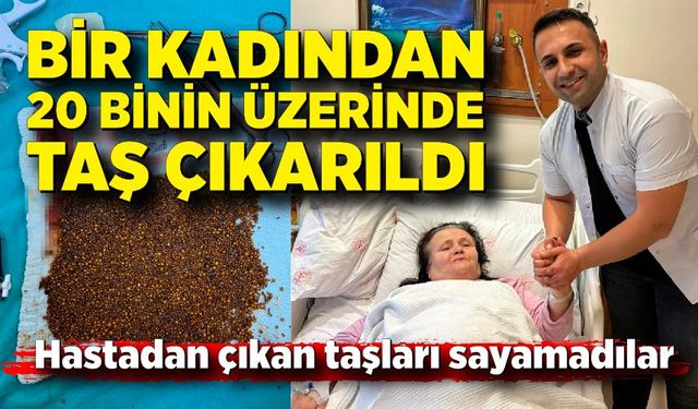 Hastadan çıkan taşları sayamadılar; Bir kadından 20 binin üzerinde taş çıkarıldı