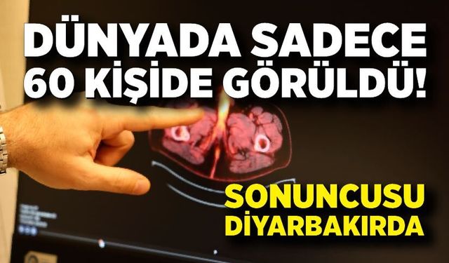 Dünyada Sadece 60 Kişide Görüldü! Penis kaybına neden oldu