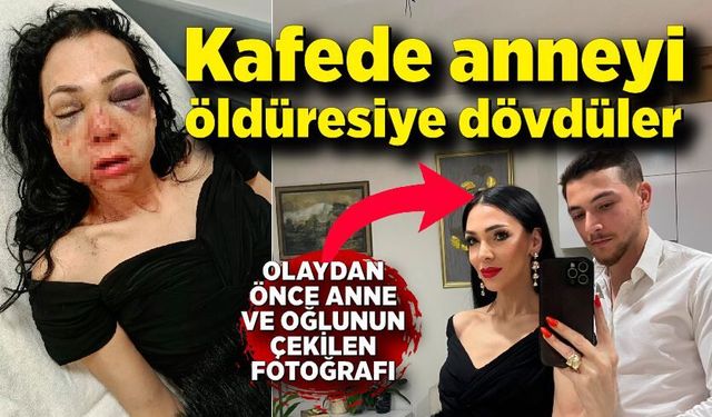 Oğlunun gözü önünde anneyi öldüresiye dövdüler: "'Küfür etmeyin' dedik diye bu hale geldim"