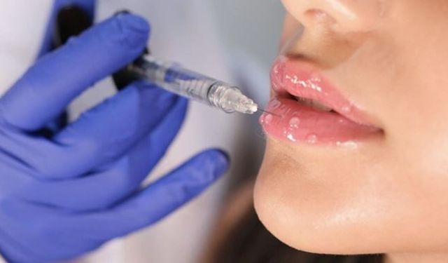 Dudak Dolgusu Fiyatları 2026: Neye Göre Değişir, Ortalama Ücretler Nedir?