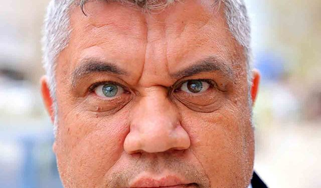 Üç renkli gözleriyle dikkat çekiyor: Gören dönüp bakıyor