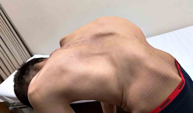 Kırgızistanlı genç şifayı Türk hekimlerinde buldu