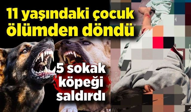5 sokak köpeğinin saldırdığı çocuk ölümden döndü