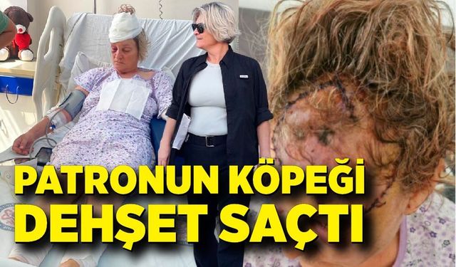 Patronun köpeği dehşet saçtı: Vücuduna 80 dikiş atılan kadın koruma ölümden döndü