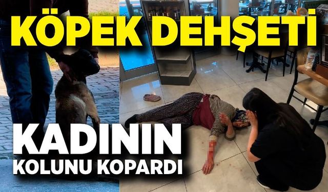 Tekmelere aldırmayan köpek kadının kolunu kopardı