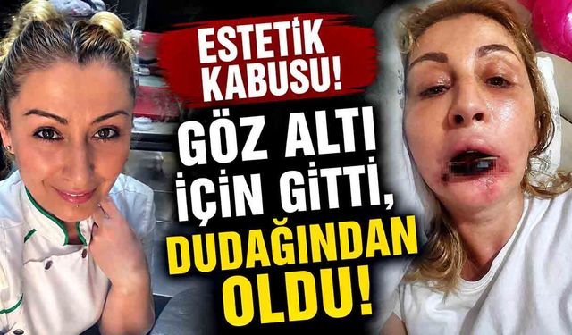 Göz altı için gitti, dudağından oldu