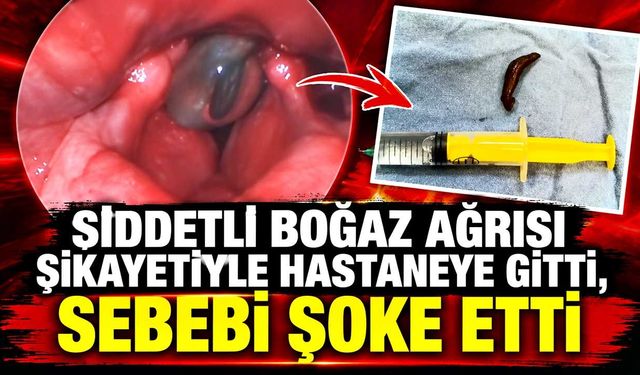 Şiddetli boğaz ağrısı şikayetiyle hastaneye gitti, sebebi şoke etti