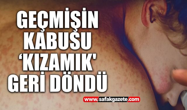 Geçmişin kabusu ‘kızamık' geri döndü